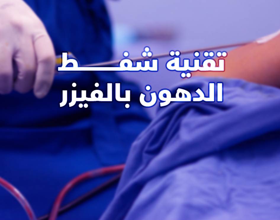 تكلفة علاج التثدي عند الرجال في مصر